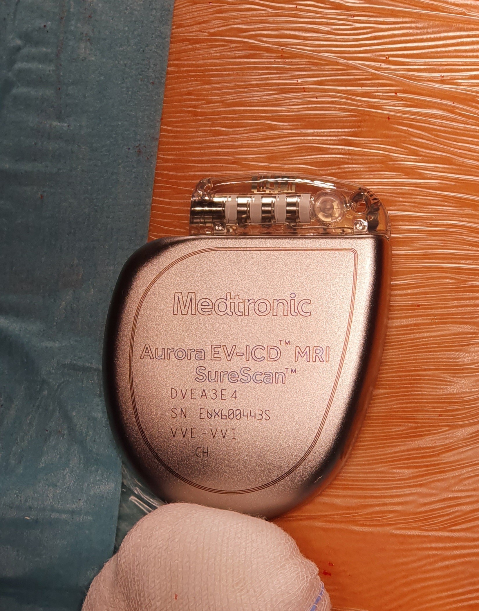 Új fejlesztésű eszközzel előzik meg a hírtelen szívhalált